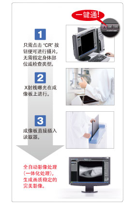 1. 只需点击CR按钮便可进行摄片，无需指定身体部位或检查类型。 2. X射线曝光在成像板上进行。 3. 成像板直接插入读取器。全自动影像处理（一体化处理），生成画质稳定的完美影像。 