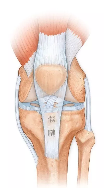 髌腱炎判断图片